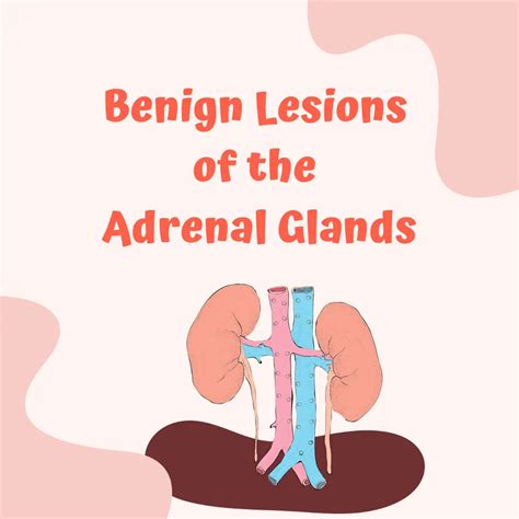 Benign Lesions Of The Adrenal Glands