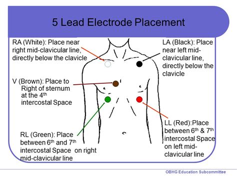 5 Lead Ekg Electrode Placement