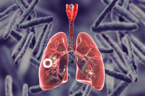 Surely the sovereign lord does on saturday 5th june 2021, prophet tb joshua spoke during the emmanuel tv partners meeting: Preventive Moxifloxacin Well-Tolerated in People With ...