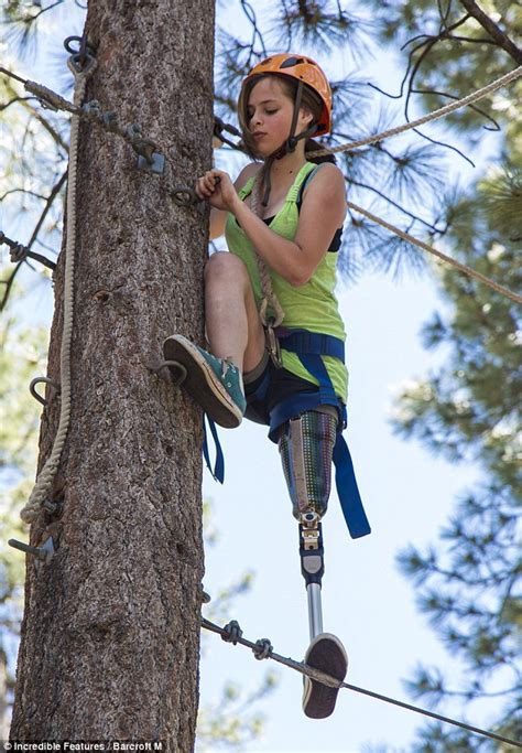 Camp No Limits Childrens Amputee Camp Provides Same Adrenalin Fuelled