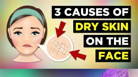 3 Causes Of Dry Skin On The Face Dry Skin Remedies Youtube