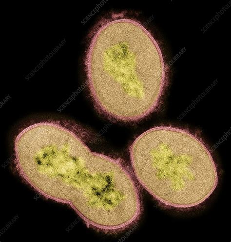 Streptococcus Bacteria Tem Stock Image C0510508 Science Photo