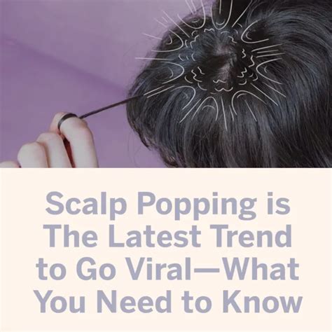 Doctors Are Begging People To Not Try The Scalp Popping Trend That Is