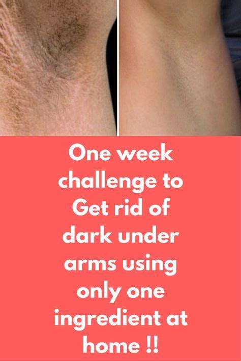 One Week Challenge To Get Rid Of Dark Under Arms Using Only One