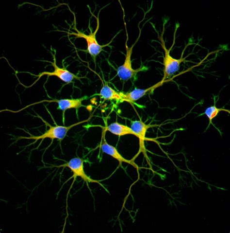Out of these cookies, the cookies that are categorized as necessary are stored on your browser as. Primary Neurons vs Neuronal Cell Lines - ScienCell ...