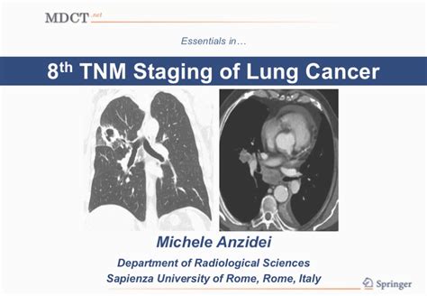 The staging system most often used for nsclc is the american joint committee on cancer (ajcc) tnm system, which is based on 3 key pieces of information 8th TNM Staging of Lung Cancer - MDCT.net
