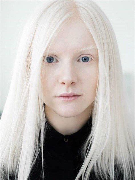 Albino Girl Albino Model White Blonde Hair