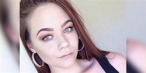 16 Year Old Shares Disturbing Images To Show Dangers Of Eyebrow Tinting