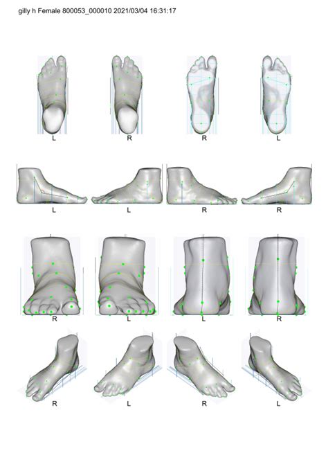 3d Scans Footwear Solutions