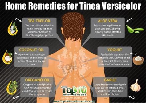 8 Best Tinea Versicolor Images On Pinterest Natural Remedies