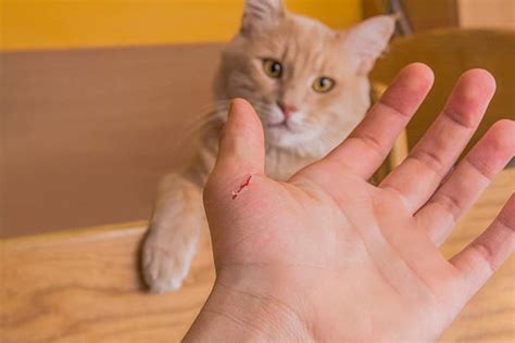 How To Treat Cat Bites And Scratches On Humans Wound Care Society