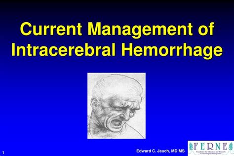 Ppt Current Management Of Intracerebral Hemorrhage Powerpoint