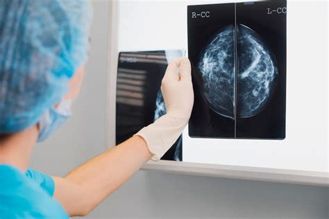 8 New Breast Cancer Treatments Some Oncologists Are Calling Mind