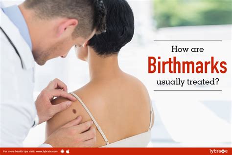 How Are Birthmarks Usually Treated By Dr Sandesh Gupta Lybrate