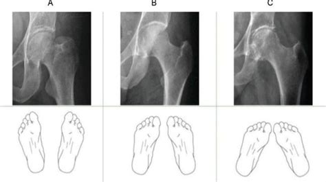 Radiography Correct Patient Positioning Is Critical • Healthcare In