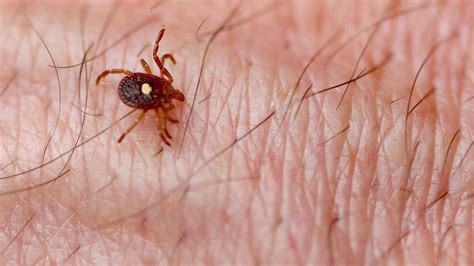 Tick That Causes Meat Allergy Is Spreading