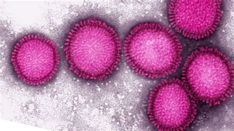 Unpredictable Pandemics Warning Bbc News