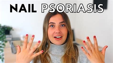 Nail Psoriasis Treatment At Home Psoriasis Update And Storytime