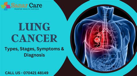 Lung Cancer Types Stages Symptoms Diagnosis