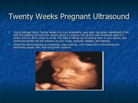 What Is Level 1 Ultrasound In Pregnancy Pregnancywalls