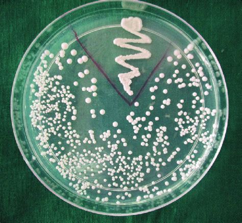 Colonies Of Candida On Sabouraud Dextrose Agar With Positive Control