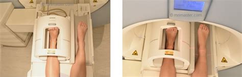 Ankle Mri Protocols And Planning Indications For Ankle Mri Scan
