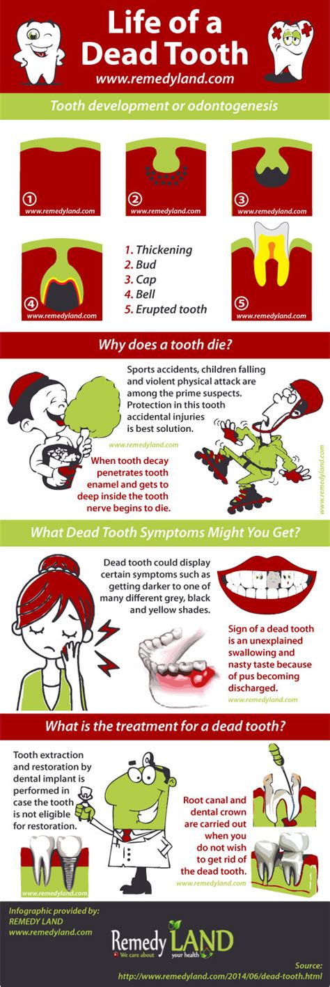 If you are suspecting you may have a dying tooth, have it checked and treated as early as possible. Dead tooth - The life of a dead tooth - Remedy Land