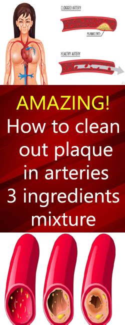 how to clean out plaque in arteries 3 ingredients mixture nutrition