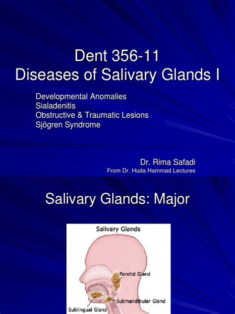 Slide 14 Diseases Of Salivary Glands I Pdf Anatomy Immunology