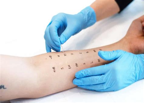 Skin Prick Test Singapore Procedure And Preparation 2022