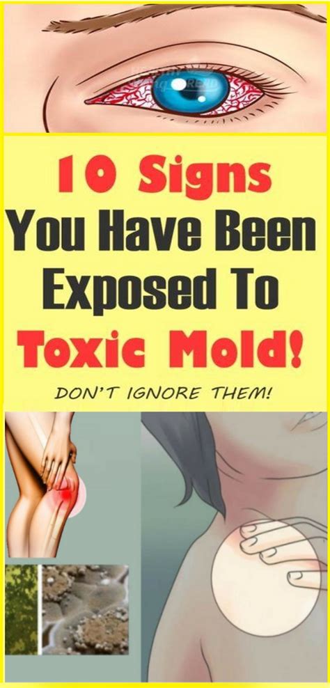 10 Signs You Have Been Exposed To Toxic Mold Healthy Lifestyle