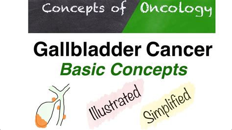 Gallbladder Cancer Basic Concepts Youtube
