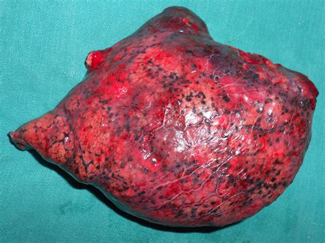 Symptoms of lung cancer in dogs in the absence of diagnostic testing, it can be challenging to detect lung cancer in dogs. lung cancer tumors Gallery