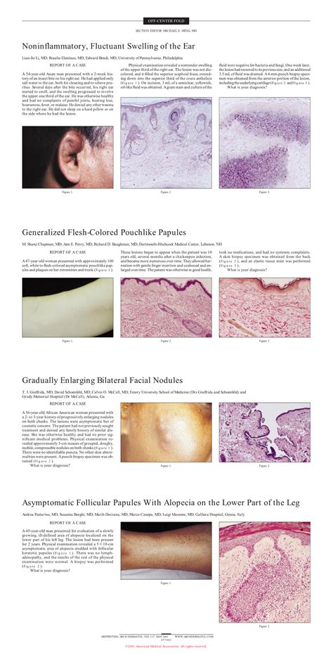 Asymptomatic Follicular Papules With Alopecia On The Lower Part Of The