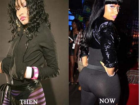 Blogging News Around World Nicki Minaj Butt Implants Photo Before And After