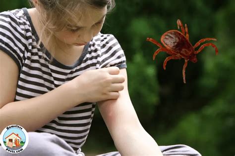 How To Identify Chigger Bites And Stop The Itch Quick Homeless Pests