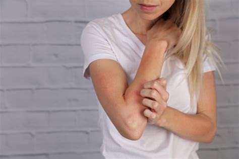 Dermatite Da Stress Cos Cause Sintomi Rimedi E Cura Prevenzione