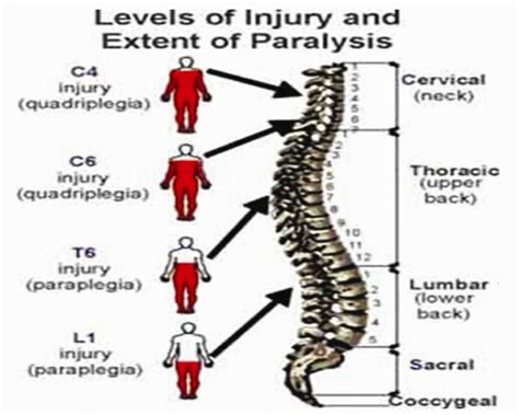 Spinal Cord Injury Levels And Function Chart Pdf