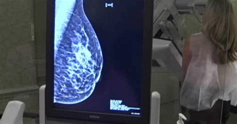 new mammogram guidelines issued