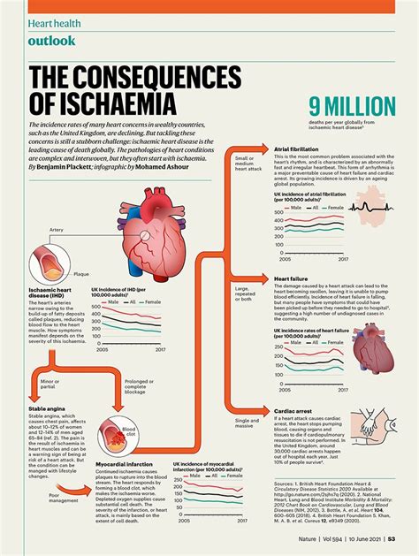 A Graphical Guide To Ischaemic Heart Disease