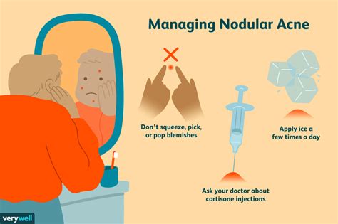 Causes Of Nodular Acne And How To Treat It