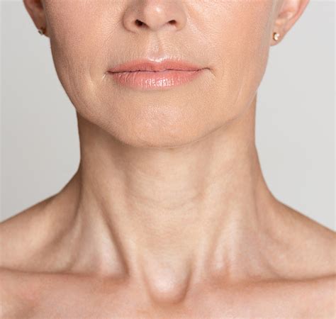 Myellevate Nonsurgical Neck Lift Clevens Face And Body Specialists