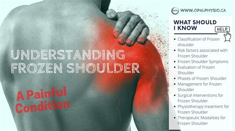 Understanding Frozen Shoulder - A Complete Guide