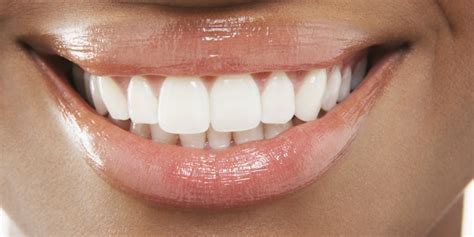 Astounding Smile Restoration With Cosmetic Dental Implants