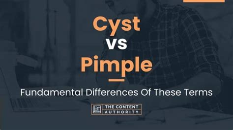 Cyst Vs Pimple Fundamental Differences Of These Terms
