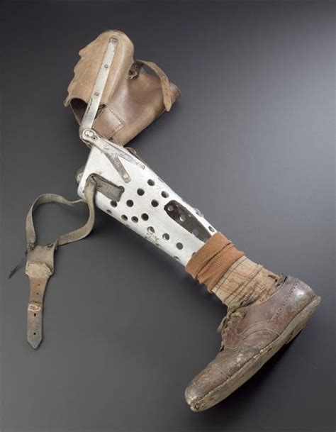 34 Best Early Prosthetic Limbs Images On Pinterest Medical History