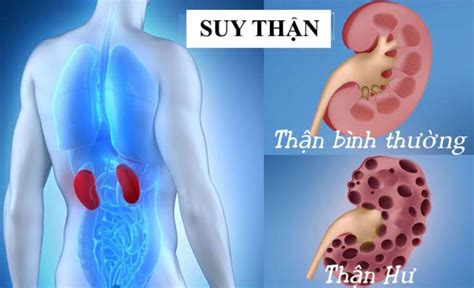 Tin Tức Cao Niên Thế Kỷ Xxi 5 Bất Thường ở Bàn Tay Cảnh Báo Bệnh Suy Thận