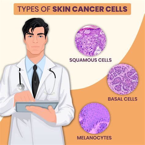 Understanding The Different Types Of Skin Cancer Treatment Zeeva Clinic My Xxx Hot Girl