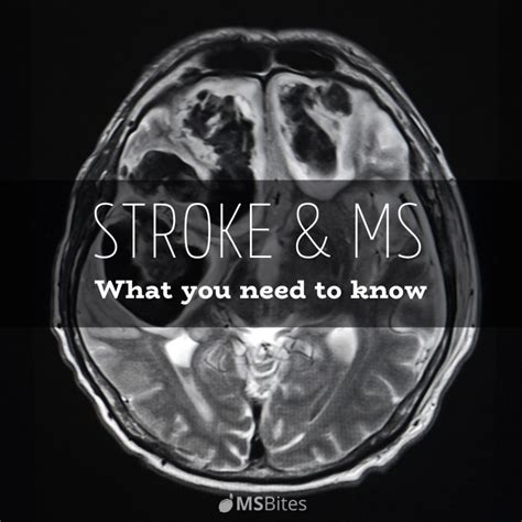 Stroke Awareness Month And Multiple Sclerosis Msbites