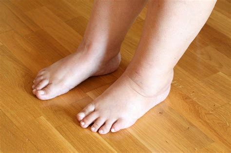 Diabetes Swollen Feet Causes Symptoms Treatment And Prevention